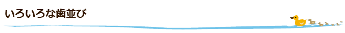 いろいろな歯並び