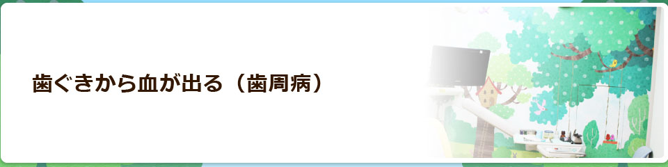歯ぐきから血が出る（歯周病）