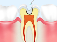 ドックベストセメント